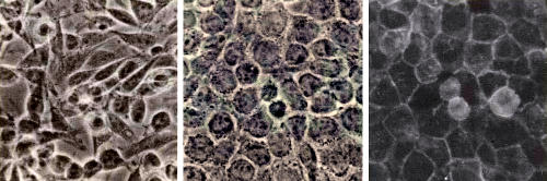 Изменение организации групп клеток под влиянием CAM видно на этих микрофотографиях, полученных в лаборатории автора. Культивируемые клетки, не имеющие гена L-CAM, формируют рыхлые скопления, похожие на мезенхиму эмбриона (слева). Если в такие клетки ввести ген L-CAM и активировать его, их пространственная организация становится более упорядоченной, напоминающей структуру эпителия (в середине). При этом на клеточной поверхности с помощью флуоресцентной метки выявляются L-CAM (светлые участки на фотографии справа)